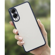 Galaxy S25 Edge Kılıf Kamera Korumalı Lensli Raz Kapak