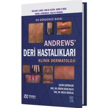 Andrews Deri Hastalıkları