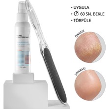 Momo Professional Pedikür İçin 2'li Avantajlı Set, Nasır Sökücü Sprey 125 ml ve Ayak Topuk Törpüsü 100/180 Grit