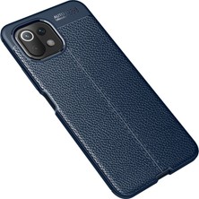 Bezos Mi 11 Lite Kılıf Auto Focus Kapak - Lacivert