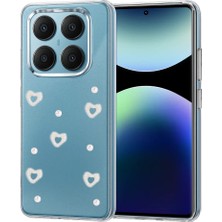 Mabelme Store Xiaomi Redmi Note 14 Pro 4g Fiyonk Desenli Kapak - Desen 10