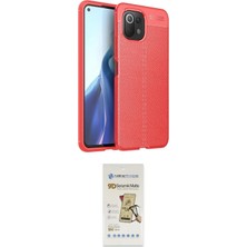 Teknoparkx Ieg™ Mi 11 Lite Kılıf Doruk Klasik Özel Seri - Siyah Mat Seramik Nano Ekran Koruyucu Tknprk-Tk