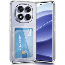 Uravas Store Xiaomi Redmi Note 14 Pro 5g Kılıf Kart Şeffaf Silikon - Şeffaf