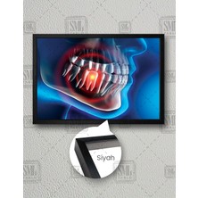 SML Tablo Ağız ve Diş Sağlığı Dişçi Diş Hekimi Ofisi Dentist Yatay Çerçeveli Kanvas Tablo