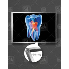 SML Tablo Diş Hekimi Ofisi Kanal Sinirler Dişçi Dentist Yatay Çerçeveli Kanvas Tablo