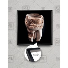 SML Tablo Diş Muayanehane Dental Sağlık Roma Kolezyum Kare Çerçeveli Kanvas Tablo
