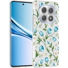 Voyo Xiaomi Redmi Note 15 4g Kılıf Kamera Korumalı Kabartma Desenli Voyklip Kapak