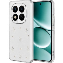 Xiaomi Redmi Note 15 Pro 4g Fiyonk Desenli Kapak - Desen 4
