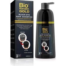 Uravas Store Saç Siyahlaştırıcı Beyaz Kapatıcı Hızlı Etkili Siyah Boya Şampuanı 400ML