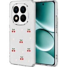 Eco Port Xiaomi Redmi Note 15 Pro Plus 5g Fiyonk Desenli Kapak - Desen 9 - Desen 9