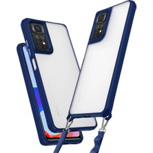 Magicool Xiaomi Redmi Note 11 Pro Kılıf Penta Silikon Kılıf - Lacivert