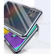 Soffy Samsung A71 Kılıf Kamera Korumalı Soft Tıpalı Silikon Kılıf Şeffaf