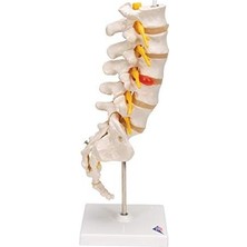 3b Scientific A76/5 Bel Omurga Sütunu, Dorso-Lateral Prolapsed Intervertebral Disk, 34 cm Yükseklik
