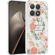 Nihcase Xiaomi 15T Kılıf Klipx Serisi Mat Desenli Tpu Kapak