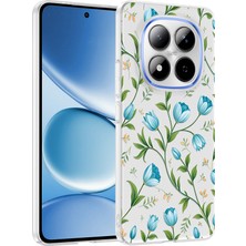 Nihcase Xiaomi Redmi Note 15 Pro 4g Kılıf Klipx Serisi Mat Desenli Tpu Kapak