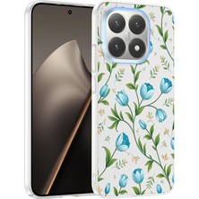 Nihcase Xiaomi 15T Kılıf Klipx Serisi Mat Desenli Tpu Kapak