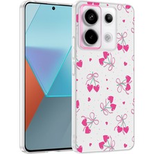 Nihcase Xiaomi Redmi Note 13 Pro 5g Kılıf Klipx Serisi Mat Desenli Tpu Kapak