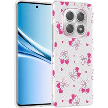 Nihcase Xiaomi Redmi Note 15 5g Kılıf Klipx Serisi Mat Desenli Tpu Kapak