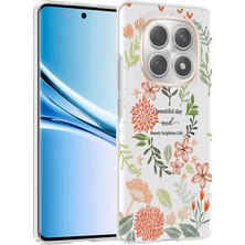 Nihcase Xiaomi Redmi Note 14 Pro 4g Kılıf Klipx Serisi Mat Desenli Tpu Kapak