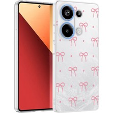 Nihcase Xiaomi Redmi Note 13 Pro 4g Kılıf Klipx Serisi Mat Desenli Tpu Kapak