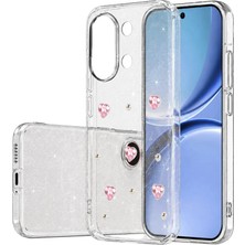 Grandor Newface Xiaomi Poco X8 Pro Max Fiyonk Desenli Kapak - Desen 3