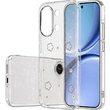 Grandor Newface Xiaomi Poco X8 Pro Max Fiyonk Desenli Kapak - Desen 2