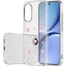 Grandor Newface Xiaomi Poco X8 Pro Fiyonk Desenli Kapak - Desen 3