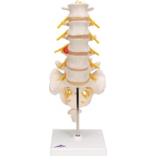 Kazan Hobi 3b Scientific A76/5 Bel Omurga Sütunu, Dorso-Lateral Prolapsed Intervertebral Disk, 34 cm Yükseklik