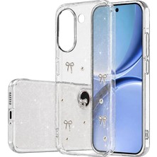 Eco Port Newface Xiaomi Poco X8 Pro Fiyonk Desenli Kapak - Desen 5