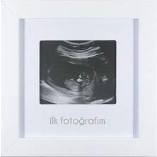 Kazan Hobi Fufizu Ilk Fotoğrafım Bebek Ultrason Çerçevesi - Bebek Odası Resim Anı Çerçevesi