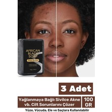 Floranova 100% Doğal Güzel Kokulu El Yüz Saç Vücut Cilt Onaran Kolajen Etkili Afrika Bitkisel Sabun 3 Adet