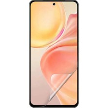 GUARDON Redmi Note 15 Ekran Koruyucu Nano 9h Özellikli Kırılmaz Ekran Koruyucu