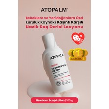 Bebeklere&yenidoğanlara Özel Konak Karşıtı Saç Derisi Losyonu Atopalm Newborn Scalp Lotion