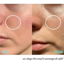 Aydogan's Gözenek Sıkılaştırıcı Cilt Serumu - 30 ml