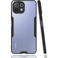 Mi 11 Lite Kılıf Platin Silikon - Siyah
