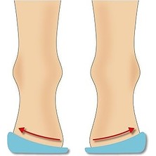 Icemen 505 Silikon Topukluk, Içe ve Dışa Basma Düzeltici, 4 Beden (XS-L),%100 Silikon Yapı (S (34-37))