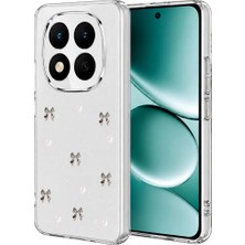 Bezos Note 15 Pro 5g Fiyonk Desenli Kapak - Desen 8