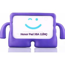 Undeplus Honor Pad X8B X8A 11INÇ ile Uyumlu Kılıf Çocuklara Özel Silikon Case