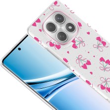 Zipax Xiaomi Redmi Note 15 4g Uyumlu Kılıf Desenli Kapak Zr-Klip