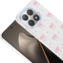 Zipax Xiaomi 15T Uyumlu Kılıf Desenli Kapak Zr-Klip