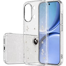 Hcc Trend Newface Xiaomi Poco X8 Pro Max Fiyonk Desenli Kapak - Desen 4