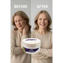 Bezos Fıtık Kurutan Krem 50 ml