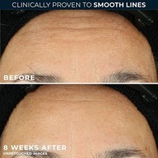 Sefa Ticaret Roc Retinol Correxion Smoothing Kırışıklık Karşıtı Kapsül Serum 10 Adet