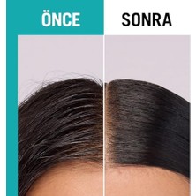 Sefa Ticaret Scalp Balance Arındırıcı Serum 100 ml