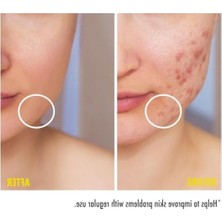 Die Grup Leke Karşıtı ve Gözenek Sıkılaştırıcı Krem, 200 ml Niacinamide ile