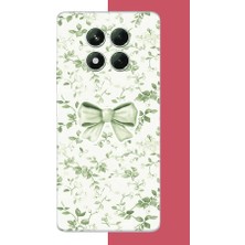 Aksesuarist Redmi Note 14 Pro 5g Uyumlu Yeşil Fiyonk Pattern Baskılı Silikon Kılıf