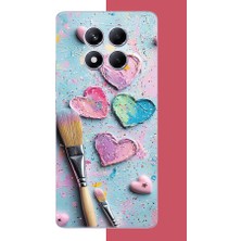 Aksesuarist Redmi Note 14 Pro Plus Uyumlu Renkli Tuval Baskılı Silikon Kılıf
