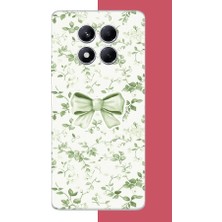 Aksesuarist Redmi Note 14 Pro Plus Uyumlu Yeşil Fiyonk Pattern Baskılı Silikon Kılıf