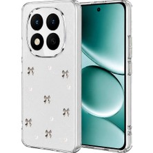 Evimdeyokyok Xiaomi Redmi Note 15 Pro 5g Fiyonk Desenli Kapak - Desen 8