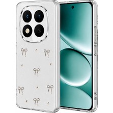 TeknoKapsül Xiaomi Redmi Note 15 4g Fiyonk Desenli Kapak - Desen 5